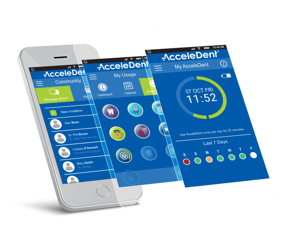 AcceleDent app