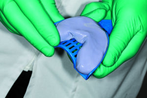 dental impression