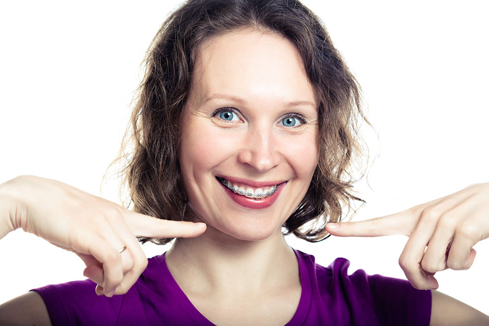 woman wearing adult braces