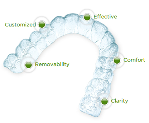 Invisalign braces
