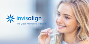 Invisalign braces