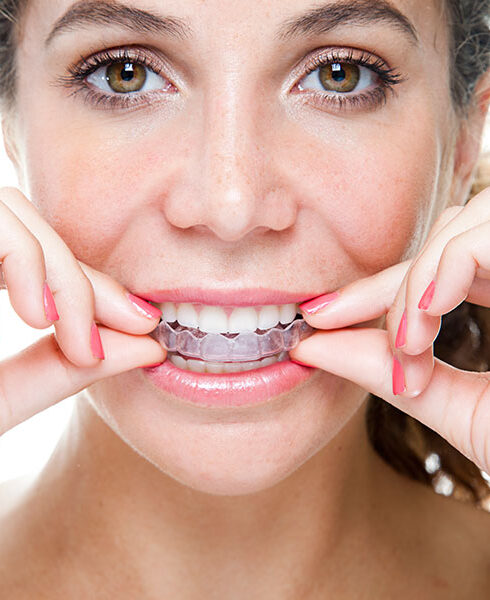 woman putting in Invisalign