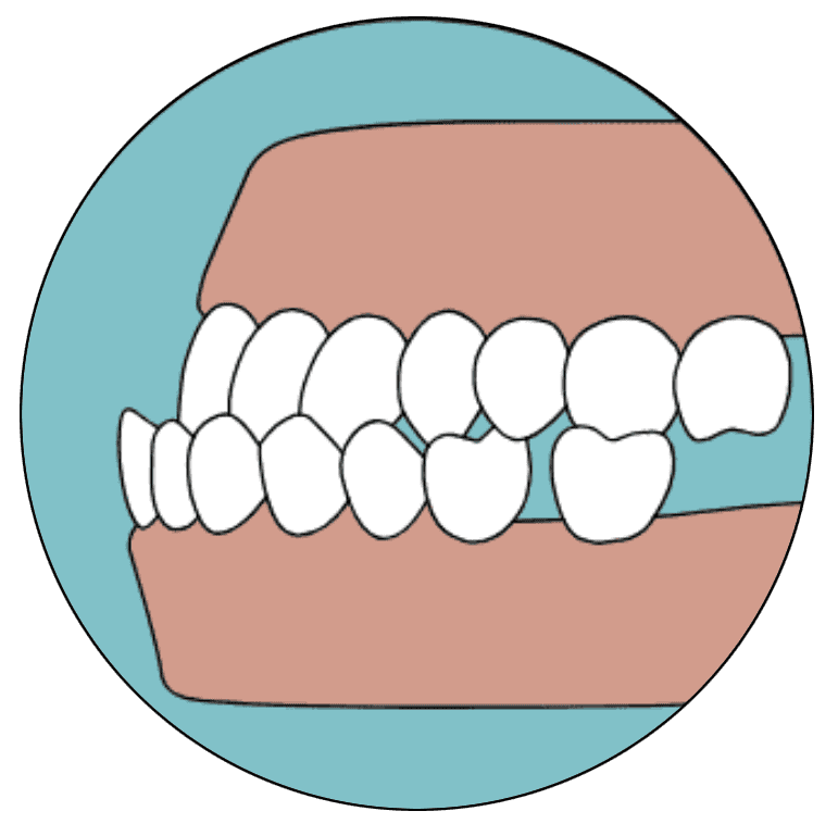 underbite graphic